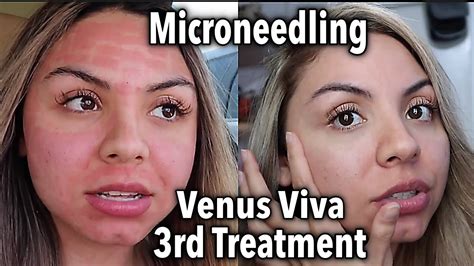 venus viva reviews